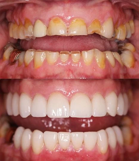 Alan_BAT harmful effects of tobacco on oral health