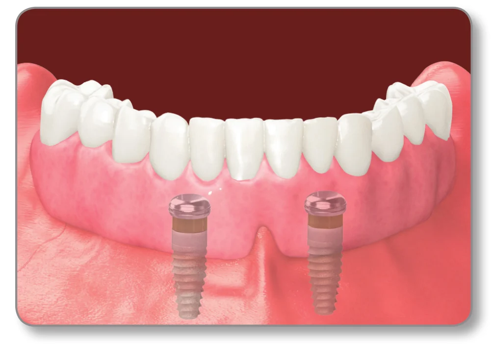 dental-services