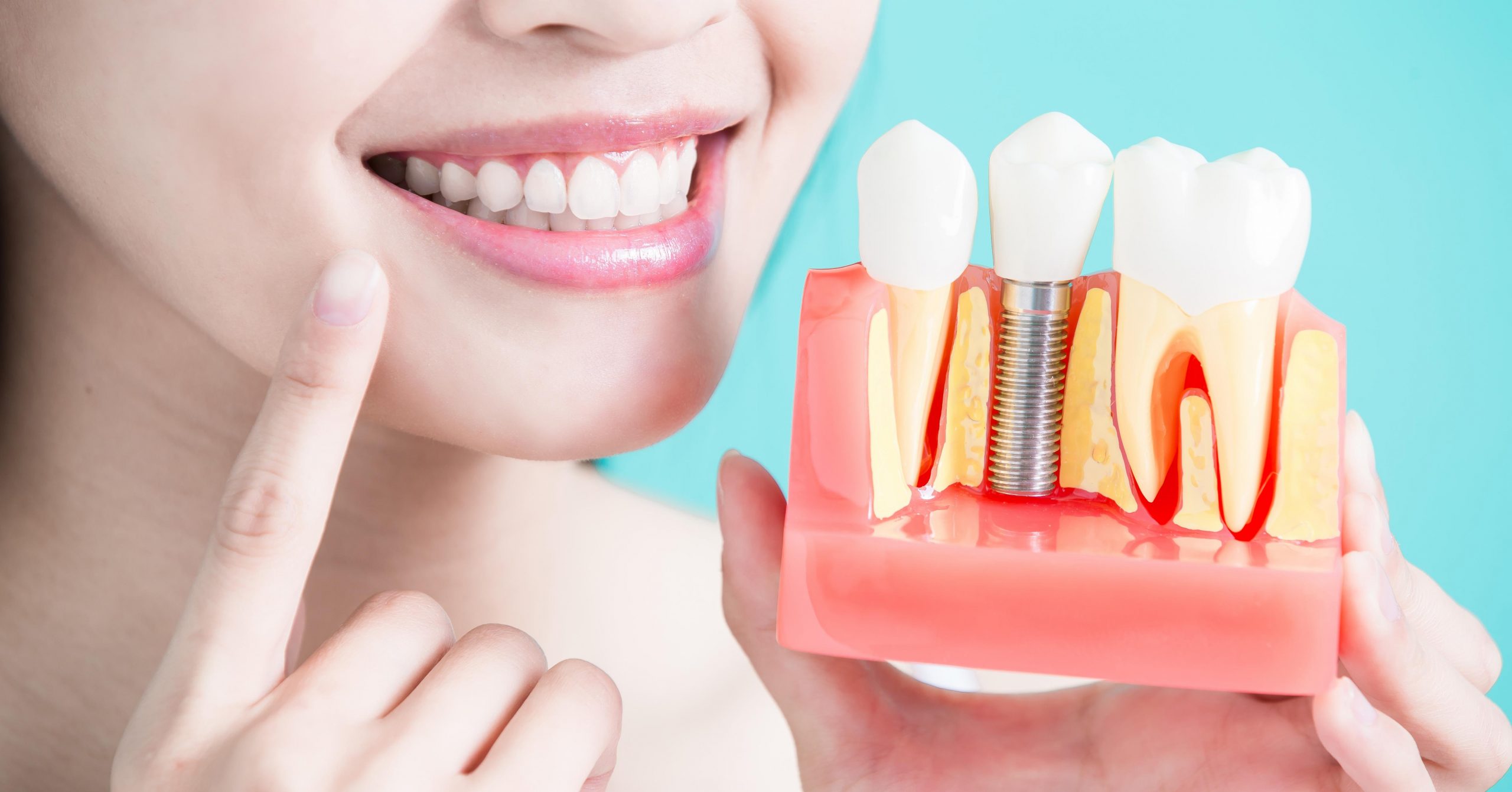 Implant Dentistry Implant Dentistry