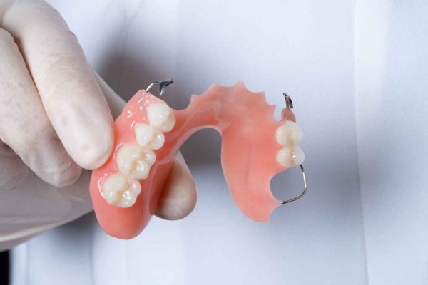 dental-services