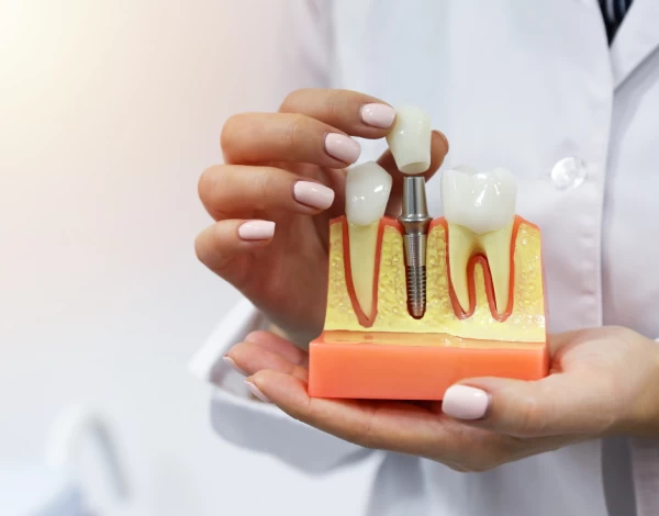 dental-services