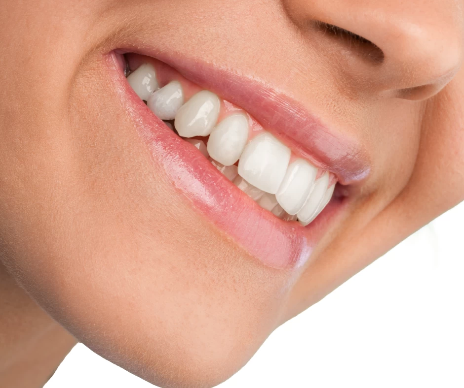 Dental Bridges