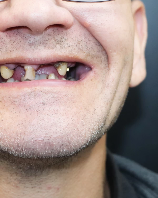 11 Oral Health with Green Bay Dentist