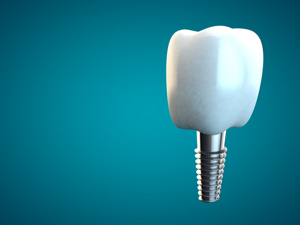 surg13 Replacing Teeth